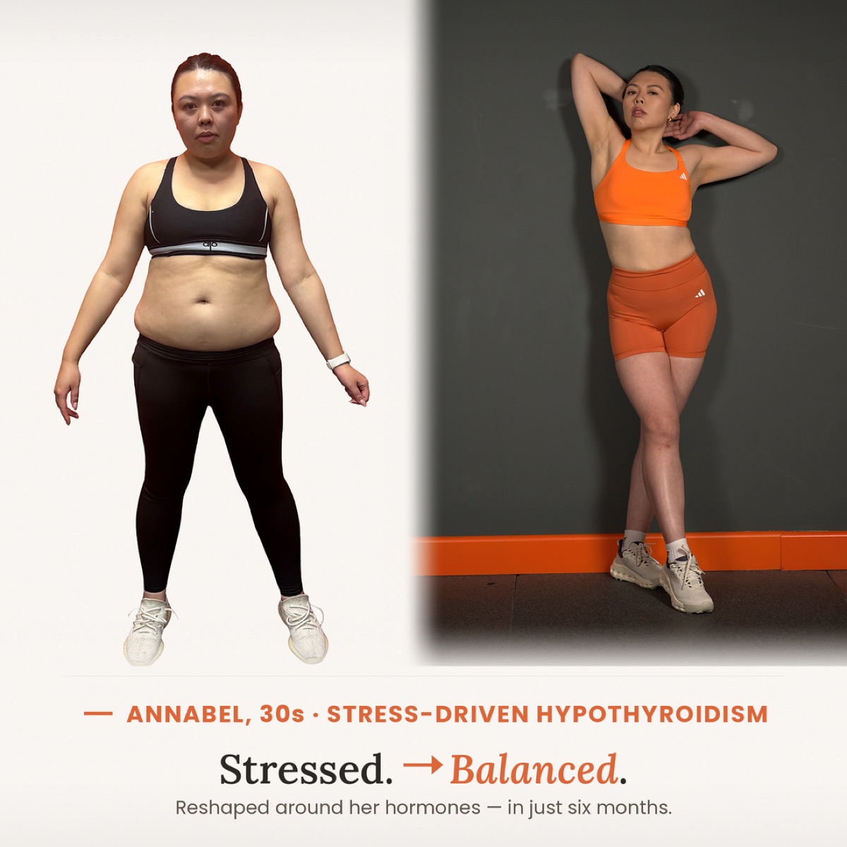 Annabel, 30s — Stress-Driven Hypothyroidism, reshaped in six months